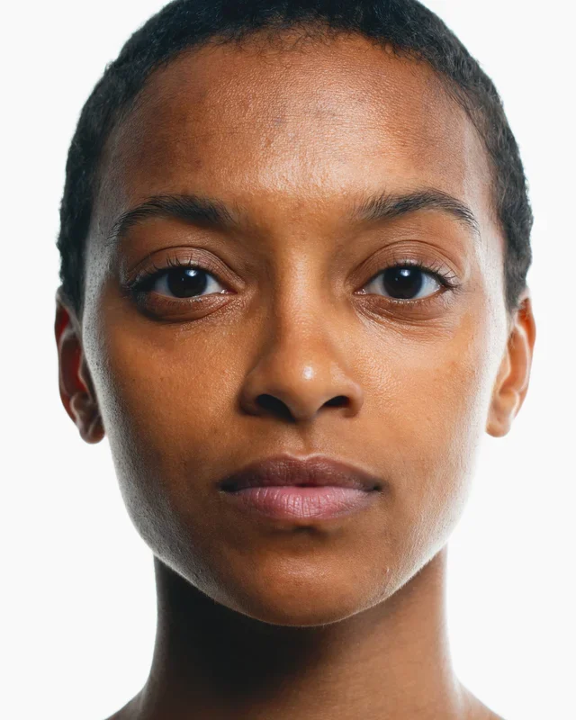 Dark skin: Can it utilize retinol?