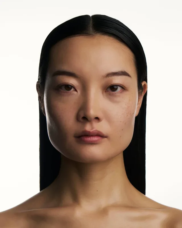 Facelift: a technique against skin laxity.