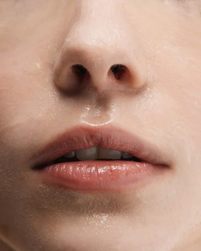 How to alleviate eczema on the mouth and lips?