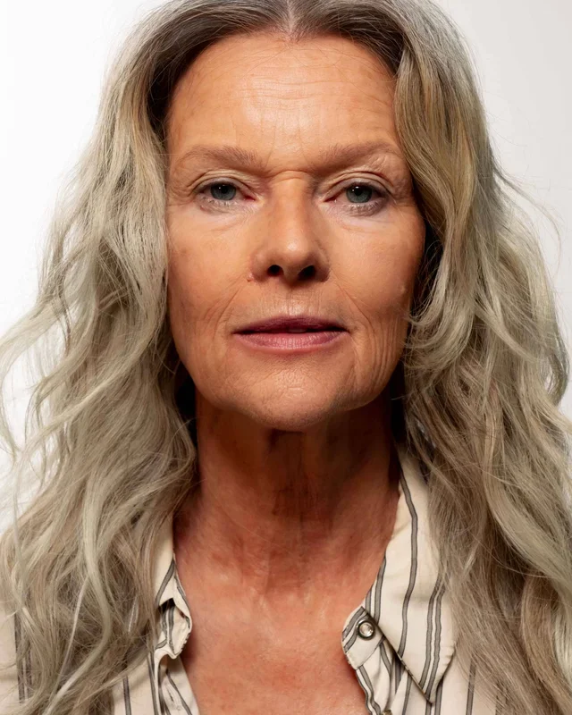 Hyaluronic Acid: The Active Ingredient Against Skin Aging.