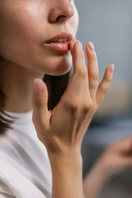 Infected chapped lips: how to identify them?