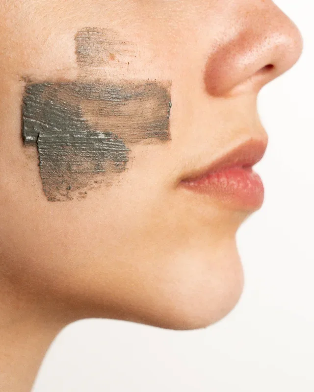 Inverse Psoriasis: What Should We Remember?