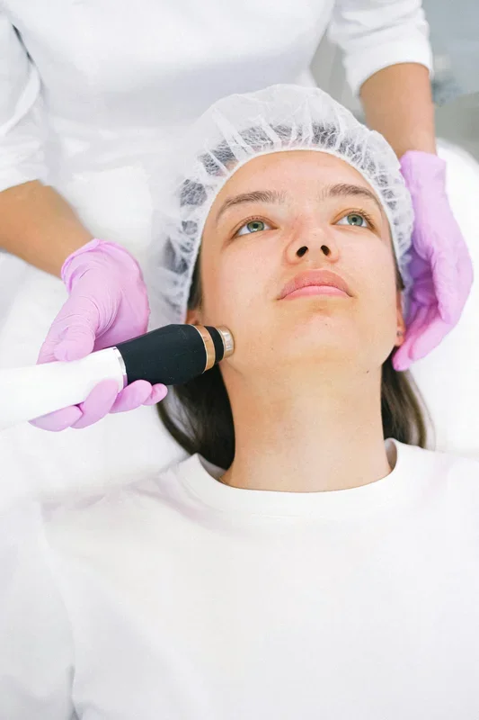 Rosacea: Laser or Pulsed Light Therapy for Treatment?