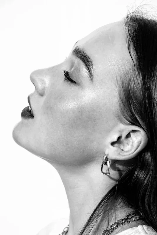 The Wnt pathway linked to hyperpigmentation?