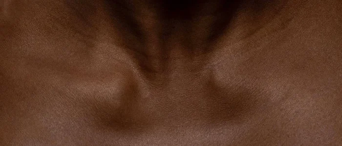 VP(.) Skin Type, what are its characteristics?